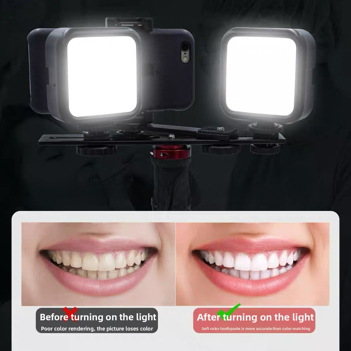 Dental Photography Light with  - Photography Lighting Basics review and price