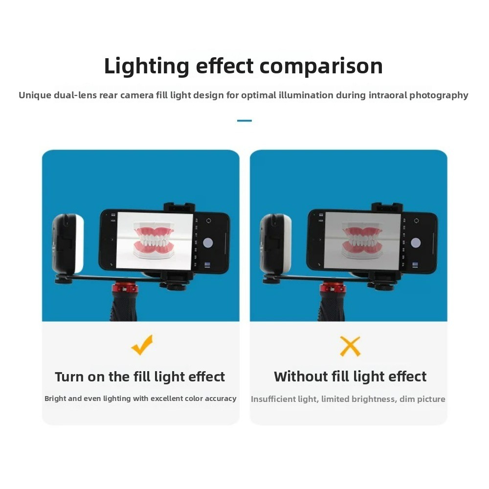 Dental Photography Light, Blue - Photography Lighting With Flash review and price
